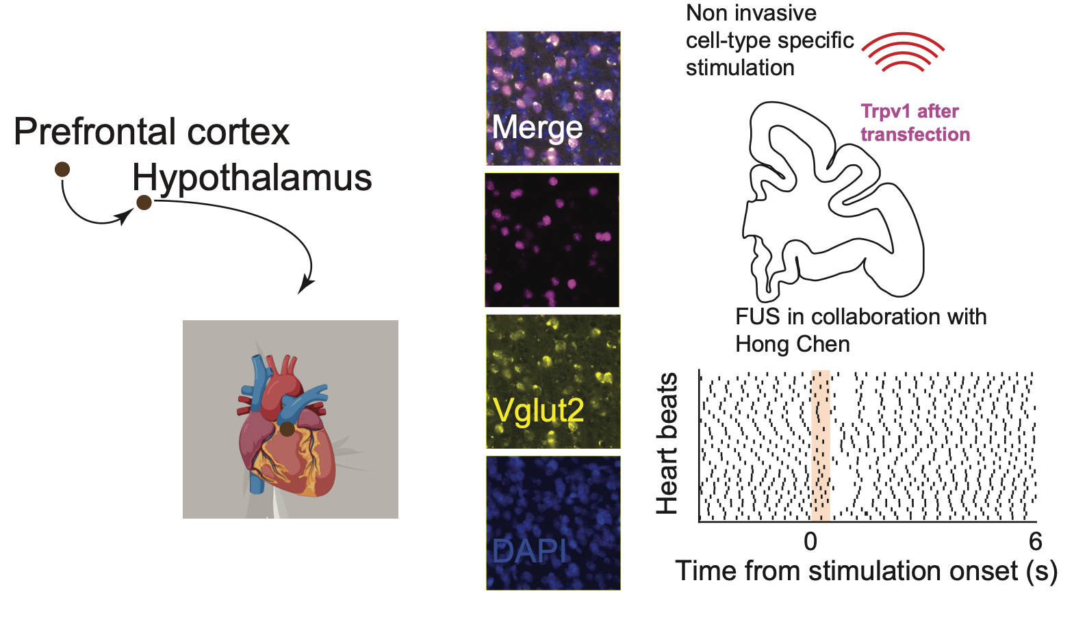 Prefrontal–hypothalamic control of the heart and noninvasive cell-type-specific ultrasound stimulation